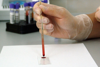 Ғалымдар 15 секундта қанды тоқтататын әдісті ойлап тапты