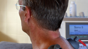 Фотография к новости: Дәрігер мойын не себепті ауыратынын түсіндірді