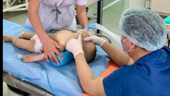 Фотография к новости: Мақтааралда 1 жасар баланың кеңірдегіне сүйек тұрып қалған