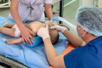 Фотография к новости: Мақтааралда 1 жасар баланың кеңірдегіне сүйек тұрып қалған