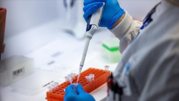 Фотография к новости: Африкада Mpoх эпидемиясы өршіп тұр