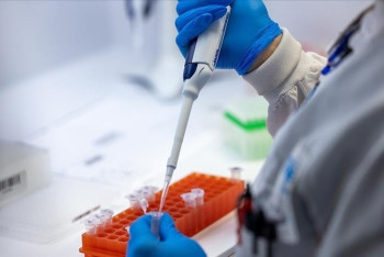 Фотография к новости: Африкада Mpoх эпидемиясы өршіп тұр