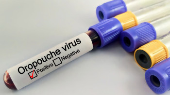 Фотография к новости: Еуропа елдерінде қауіпті вирус таралып жатыр