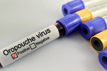 Фотография к новости: Еуропа елдерінде қауіпті вирус таралып жатыр