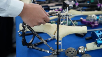 Фотография к новости: Дәрігерлер екі күнде 14 бірегей ота жасады