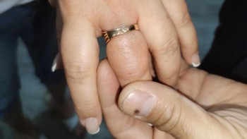 Фотография к новости: Саусағынан сақинасын шығара алмай құтқарушыларға жүгінді