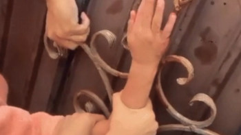 Фотография к новости: Маңғыстауда 7 жасар қыздың қолына арматура кіріп кеткен