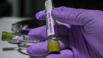 Фотография к новости: Австрия тұрғыны көршісіне коронавирус жұқтырғаны үшін сотталды