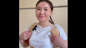 Фотография к новости: Хирургтар жас қызға сколиоздың ауыр түрінен құтылуға көмектесті