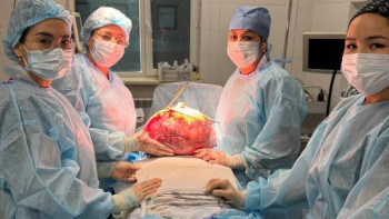 Фотография к новости: Тараз дәрігерлері 50 жастағы әйелден 15 кг болатын үлкен миоманы алып тастады