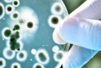 Фотография к новости: Елімізде сібір жарасымен сырқаттанушылар саны екі есе төмендеді