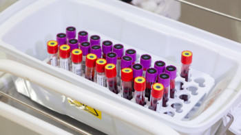 Фотография к новости: Ақтөбе облысында 59 адам АИТВ инфекциясын жұқтырған