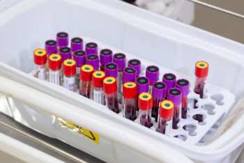 Ақтөбе облысында 59 адам АИТВ инфекциясын жұқтырған