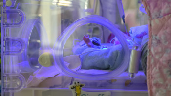 Фотография к новости: Қазақстанда жаңа туған нәрестенің шетінеуі 4 есеге азайған