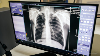 Фотография к новости: Пневмония кезінде уақытылы диагноз қойып, емді ерте бастау маңызды – дәрігер