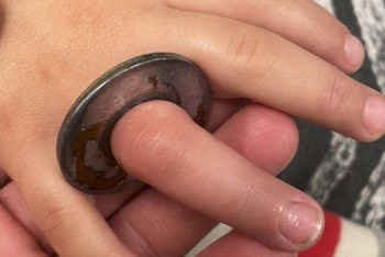 Атырауда 5 жасар баланың саусағы шайбаға қысылып қалған