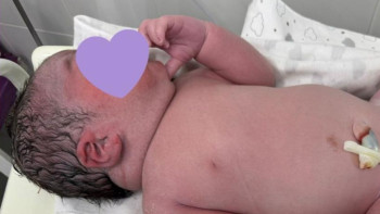 Фотография к новости: Маңғыстауда "алып бала" дүниеге келді