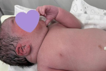 Фотография к новости: Маңғыстауда "алып бала" дүниеге келді