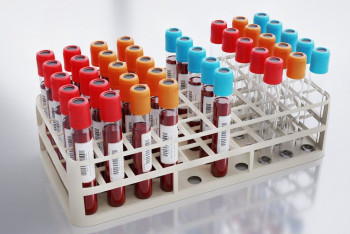 Конгода белгісіз аурудан 53 адам көз жұмды