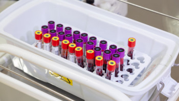 Фотография к новости: Гематолог: Қан аурулары ұзақ уақыт бойы білінбеуі мүмкін