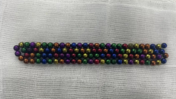 Фотография к новости: Алматыда 2 жасар бала 105 түйір магнит жұтып қойған