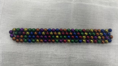 Алматыда 2 жасар бала 105 түйір магнит жұтып қойған