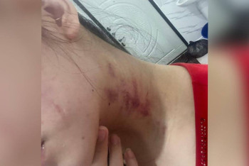 Фотография к новости: Суицид пе, қастандық па: ата-ана қызының өліміне күйеу баласынан күдіктеніп отыр