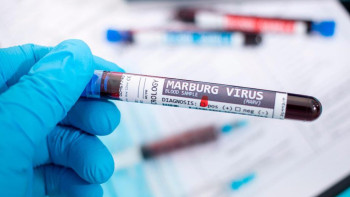 Фотография к новости: Марбург вирусы: Дүниежүзілік денсаулық сақтау ұйымы мәлімдеме жасады