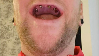 Фотография к новости: Энергетикалық сусындардың "энергиясынан" тісінен айырылды