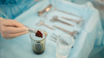 Фотография к новости: Баланы неше жаста сүндеттеген дұрыс?