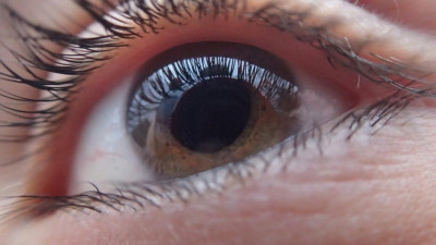 Көзге теріскен шығу ненің белгісі?