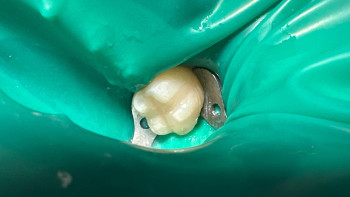 Фотография к новости: Адам тісі алғаш рет зертханада өсірілді: стоматологияда төңкеріс болуы мүмкін