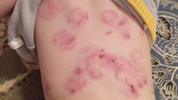 Фотография к новости: "Айғыр талағандай": Балабақшадағы оқиғаға қатысты білім бөлімі жауап берді