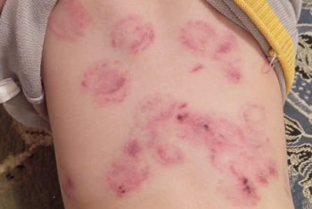 "Айғыр талағандай": Балабақшадағы оқиғаға қатысты білім бөлімі жауап берді