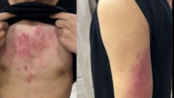 Фотография к новости: Атырауда мектеп оқушылары қос жасөспірімді аяусыз соққыға жыққан