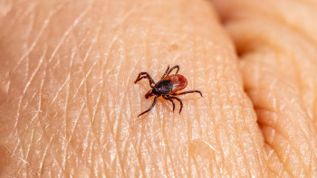 Фотография к новости: Алматыда 900-ден астам адамды кене шаққан