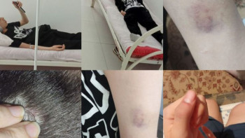 Фотография к новости: Мектеп оқушысы сыныптасын аяусыз соққыға жыққан