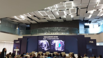 Фотография к новости: Елімізде жыл сайын 4 мыңға жуық сәби ақаумен дүниеге келеді