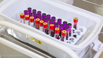 Фотография к новости: "Сезілмейтін сырқат": Енді қатерлі ісікті ерте анықтауға болады