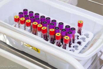 Фотография к новости: "Сезілмейтін сырқат": Енді қатерлі ісікті ерте анықтауға болады