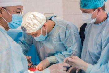 Оралда дәрігерлер жарты келі шаш жұтқан қызды құтқарып қалды