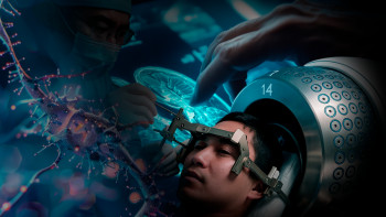 Фотография к новости: "Гамма‑пышақ" дәуірі: Қазақстан нейрохирургиясы жаңа белеске шықты