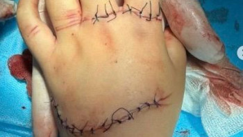 Фотография к новости: Ақтөбеде ойын паркінде қолы жараланған баланың анасы үндеу жариялады