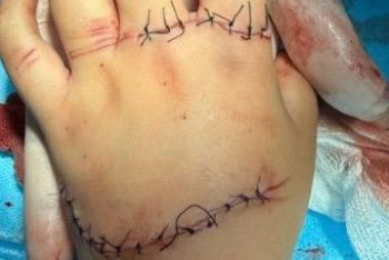 Ақтөбеде ойын паркінде қолы жараланған баланың анасы үндеу жариялады