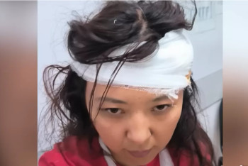 Фотография к новости: 8 минут ұрып-соққан: Қарағандыда медбике соққыға жығылды