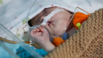 Фотография к новости: Ең кішкентай батыр: 283 грамм болып туған сәби тірі қалып, әлем рекордын жаңартты