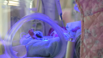 Фотография к новости: "Бүйрегі жоқ, жағдайы ауыр". Дәрігерлер анасы терезеден лақтырған балалардың жағдайы туралы айтты