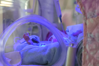 Фотография к новости: "Бүйрегі жоқ, жағдайы ауыр". Дәрігерлер анасы терезеден лақтырған балалардың жағдайы туралы айтты