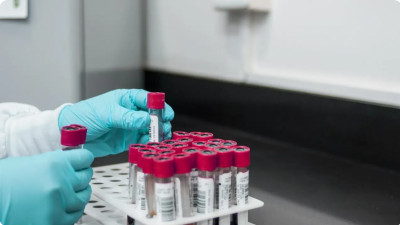 Шетелде 90 күннен астам болған Өзбекстан азаматтары ВИЧ-ке тест тапсырады