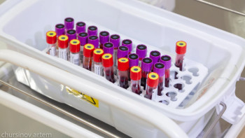 Фотография к новости: Өзбекстанда алғаш рет азаматтар ВИЧ-тестін тапсыруға міндетті болады